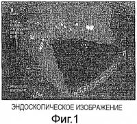 Твердая композиция для перорального введения красителей и их диагностическое применение Твердая композиция для перорального введения красителей и их диагностическое применение