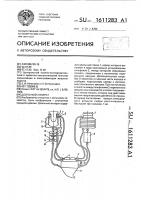 Доильный аппарат Доильный аппарат
