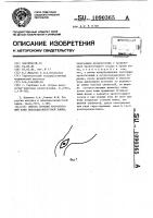 Способ лечения кровоточащей язвы двенадцатиперстной кишки Способ лечения кровоточащей язвы двенадцатиперстной кишки