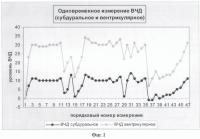 Способ определения причин внутричерепной гипертензии в остром периоде субарахноидального кровоизлияния после разрыва артериальных аневризм Способ определения причин внутричерепной гипертензии в остром периоде субарахноидального кровоизлияния после разрыва артериальных аневризм