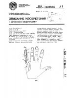 Устройство для фиксации костных отломков Устройство для фиксации костных отломков