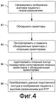 Автоматизированное оконтуривание анатомии для планирования терапии с управлением по изображениям Автоматизированное оконтуривание анатомии для планирования терапии с управлением по изображениям