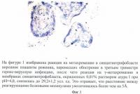 Способ оценки проницаемости мембраны синцитиотрофобласта ворсинок плаценты методом метахромазии у рожениц, перенесших в третьем триместре обострение герпес-вирусной инфекции с титром антител 1:12800 Способ оценки проницаемости мембраны синцитиотрофобласта ворсинок плаценты методом метахромазии у рожениц, перенесших в третьем триместре обострение герпес-вирусной инфекции с титром антител 1:12800