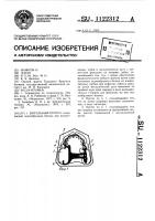 Бюгельный протез Бюгельный протез