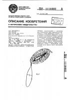 Способ аннулопликации атривентрикулярных отверстий сердца Способ аннулопликации атривентрикулярных отверстий сердца