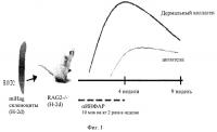 Способы лечения склеродермии Способы лечения склеродермии