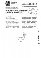 Способ лечения недоразвития нижней челюсти Способ лечения недоразвития нижней челюсти