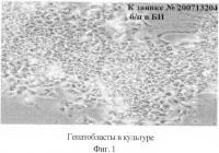 Биотрансплантат, способ лечения хронических заболеваний печени и способ лечения цирроза печени и портальной гипертензии Биотрансплантат, способ лечения хронических заболеваний печени и способ лечения цирроза печени и портальной гипертензии
