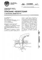 Способ декомпрессии кишечника Способ декомпрессии кишечника