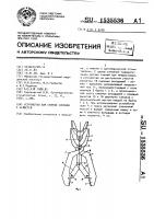 Устройство для снятия слепков с челюстей Устройство для снятия слепков с челюстей
