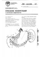 Способ лечения язвенной болезни желудка Способ лечения язвенной болезни желудка