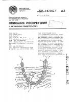 Хирургический дренаж Хирургический дренаж