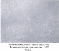 Биотрансплантат для коррекции дефектов мягких тканей (варианты), способ получения биотрансплантата (варианты) и способ коррекции дефектов мягких тканей Биотрансплантат для коррекции дефектов мягких тканей (варианты), способ получения биотрансплантата (варианты) и способ коррекции дефектов мягких тканей