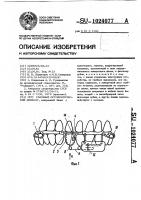 Съемный ортодонтический аппарат Съемный ортодонтический аппарат