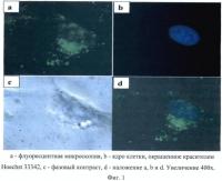 Состав препарата и способ его получения для лечения хронических вирусных гепатитов в или с и спида Состав препарата и способ его получения для лечения хронических вирусных гепатитов в или с и спида