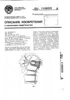 Устройство для остеосинтеза костных фрагментов тазобедренного сустава Устройство для остеосинтеза костных фрагментов тазобедренного сустава