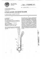 Устройство для корригирующей остеотомии длинных трубчатых костей Устройство для корригирующей остеотомии длинных трубчатых костей