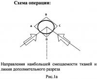 Способ пластического замещения дефектов кожи двумя смежными ротационными лоскутами Способ пластического замещения дефектов кожи двумя смежными ротационными лоскутами