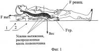 Способ и устройство для коррекции и лечения позвоночника Способ и устройство для коррекции и лечения позвоночника