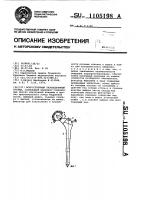 Искусственный тазобедренный сустав Искусственный тазобедренный сустав