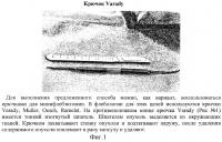 Способ удаления сухожильного ганглия, гигромы, небольшой эпидермальной кисты из мини-доступа с использованием крючка Способ удаления сухожильного ганглия, гигромы, небольшой эпидермальной кисты из мини-доступа с использованием крючка