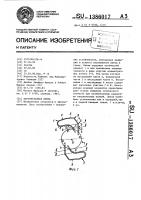 Внутриглазная линза Внутриглазная линза