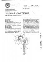 Устройство для эндопротезирования тезобедренного сустава Устройство для эндопротезирования тезобедренного сустава