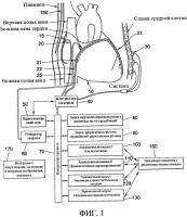 Способы, система и устройство для обнаружения, диагностики и лечения нарушений биологического ритма Способы, система и устройство для обнаружения, диагностики и лечения нарушений биологического ритма
