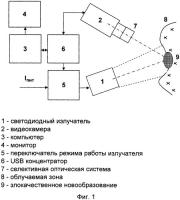 Устройство для флуоресцентной диагностики злокачественных новообразований Устройство для флуоресцентной диагностики злокачественных новообразований