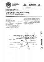 Способ лечения переломов кости Способ лечения переломов кости