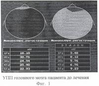 Фармацевтическая композиция, включающая холина альфосцерат и гопантеновую кислоту (или ее соль), для лечения недостаточности кровообращения мозга и эректильной дисфункции Фармацевтическая композиция, включающая холина альфосцерат и гопантеновую кислоту (или ее соль), для лечения недостаточности кровообращения мозга и эректильной дисфункции