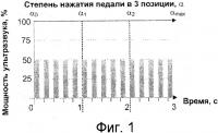 Способ ультразвуковой факоэмульсификации Способ ультразвуковой факоэмульсификации