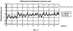 Способ подавления нистагма при движении глаз в различных направлениях (патент 2405406)