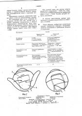 Способ хирургического лечения прогрессирующей близорукости (патент 1146039)