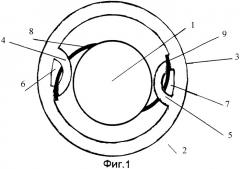 Искусственный хрусталик глаза с дозированным интраокулярным изменением оптической силы (патент 2281064)