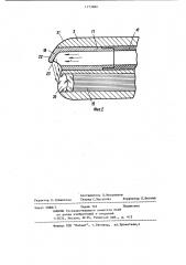 Гастроскоп (патент 1173980)