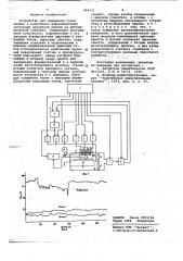 Устройство для измерения токов записи и разрушения информационных состояний магнитной пленки на цилиндрической подложке (патент 664131)