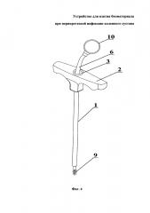 Устройство для взятия биоматериала при перипротезной инфекции коленного сустава (патент 2638786)