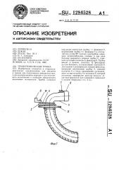 Трахеотомическая трубка (патент 1284528)