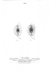 Искусственный хрусталик (патент 545352)