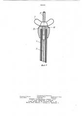 Хирургический аппарат для формирования анастомозов на пищеварительном тракте (патент 1082409)