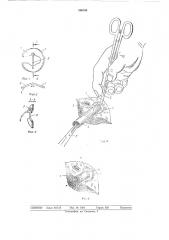Устройство для фиксации концов сухожилий (патент 500800)