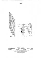 Система крепления эндопротеза диафиза к кости (патент 581937)