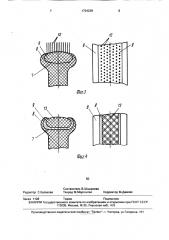 Массажное устройство (патент 1724239)
