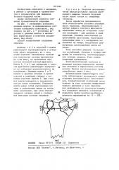 Способ лечения внутрисуставных переломов (патент 1181644)