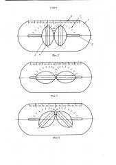 Устройство для отработки гимнастами круговых движений на коне (патент 1155275)