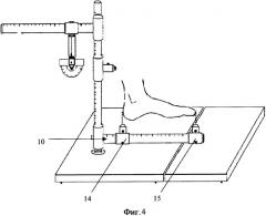 Устройство для измерения размеров голеностопного сустава и стопы (патент 2325108)