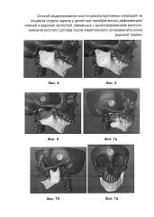 Способ моделирования костно-реконструктивных операций на лицевом отделе черепа у детей при приобретенных деформациях нижней и верхней челюстей, связанных с анкилозированием височно-нижнечелюстного сустава после гематогенного остеомиелита и/или родовой травмы (патент 2604774)