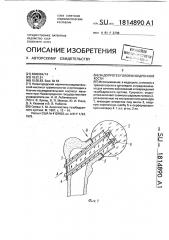 Эндопротез головки бедренной кости (патент 1814890)