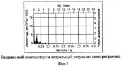 Способ функциональной предоперационной диагностики послеоперационных осложнений у пациентов после протезирующей герниопластики по поводу послеоперационных грыж (патент 2491885)